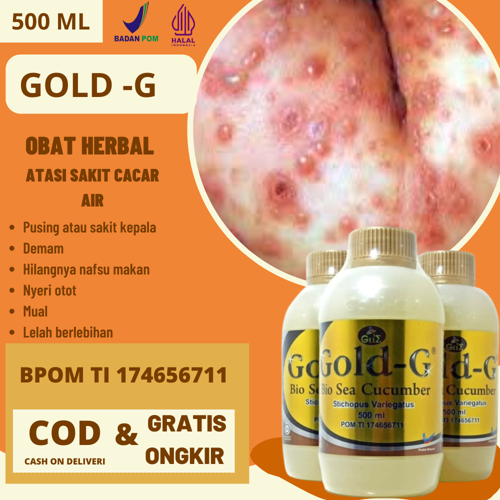 Obat Cacar Air Pada Anak Cacar Di Tangan Cacar Di Punggung Gatal Gatal Seleuruh Badan Terbaik Di Apo