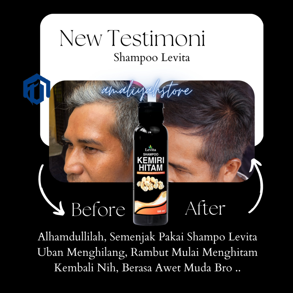 Shampoo Levita Minyak Kemiri Bakar Pemanjang Shampo Pengitam Penghilang Ketombe Rambut Beruban Super Cepat  Pria Dan Wanita Permanen Paling Ampuh Original Bpom