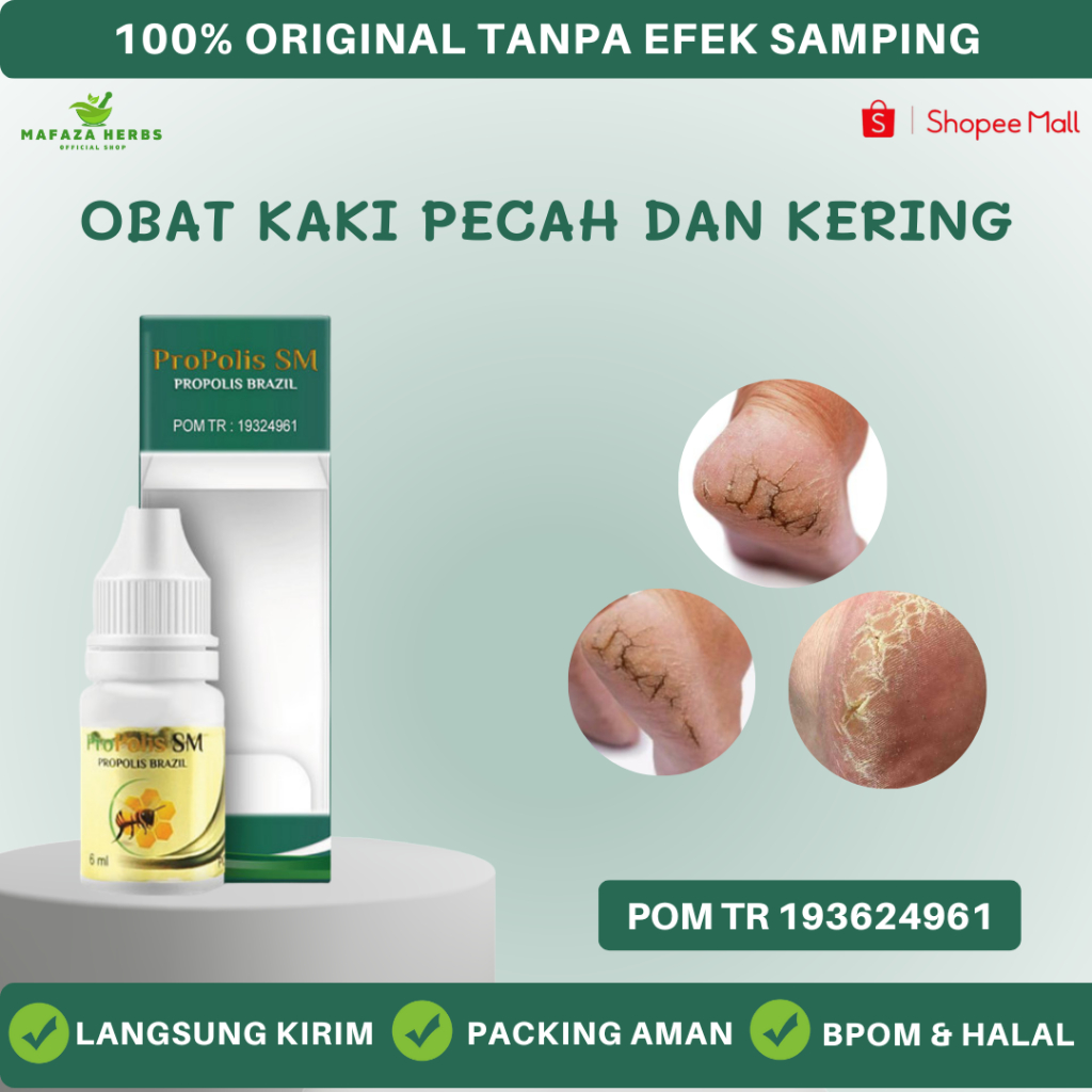 Obat Kaki Pecah Dan Kering, Obat Kaki Pecah Pecah, Rorombeheun, Jamur kaki Kutu Air Dengan Propolis