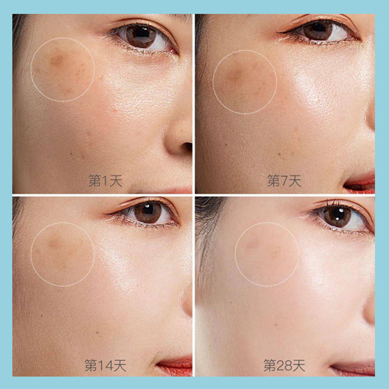 Dark Spot Serum masker freckle Brightening Anti Freckle Cream  Whitening Freckle Cream ORI Bintik menghilangkan / Chloasma / Bintik-bintik