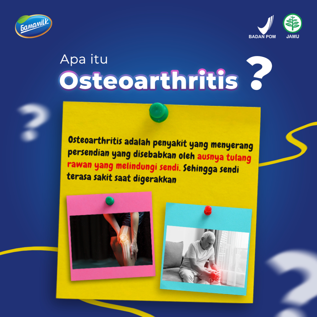 GAMAMILK SUSU ETAWA PREMIUM CEGAH OSTEOPHOROSIS DAN RADANG SENDI