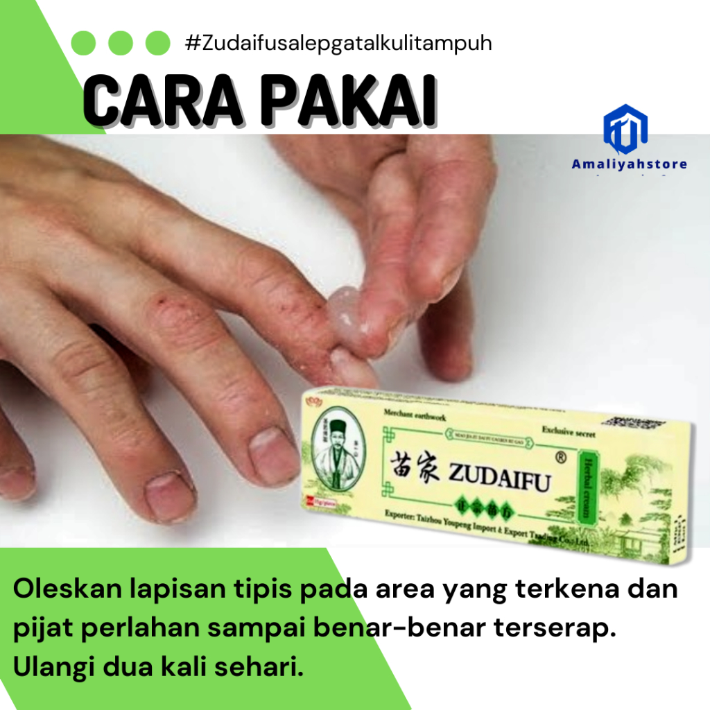 Salep Gatal Selangkangan Obat Gatal Jamur Kulit Paling Ampuh Anak Dan Dewasa Zudaifu Salep Gatal Kudis Original 15gr Original