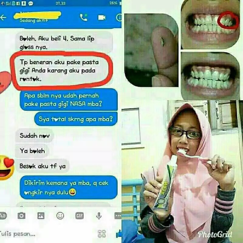 ✿ELYSABETHME✿ Pasta gigi odol nasa obral murah resmi menghilangkan plak dan bau mulut mencegah teeth  berlubang