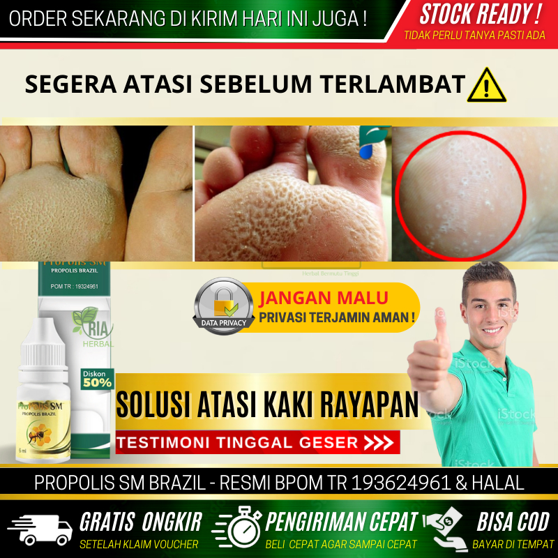 Obat Kaki Rayapan Dan Pecah Pecah Kering, Menghilangkan Bau Kaki, Penghilang Bau Kaki Akibat Bakteri