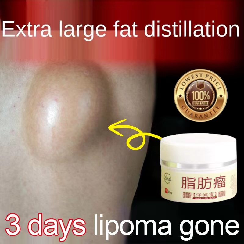 Obat Benjolan lipoma Obat benjolan  Leher Benjolan  Tangan Benjolan  Ketiak Benjolan  Punggung Punda