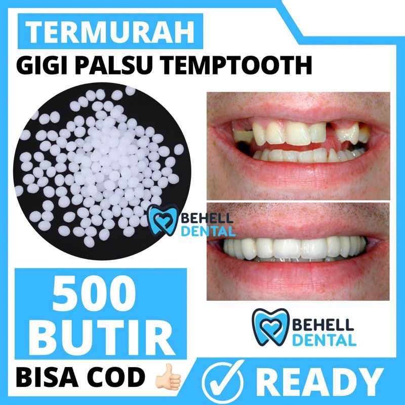 Penambal gigi berlubang/patah