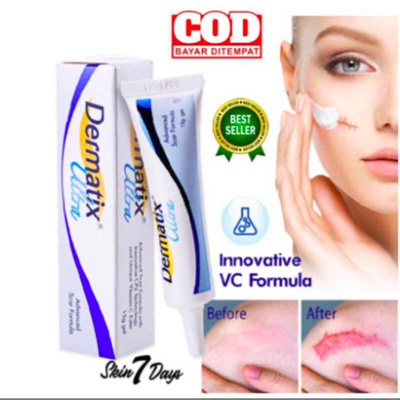 Dermatix Ultra Gel 15g Penghilang Bekas Luka / Keloid ANTI SCAR Stretc