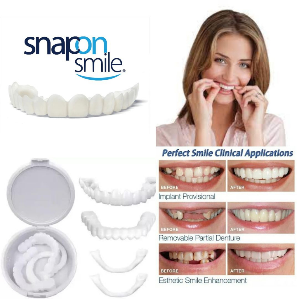 ✅[ TERLARIS ] Snap On Smile / Perfect smile snap on smile / VENEER GIGI /  gigi palsu snap on instan