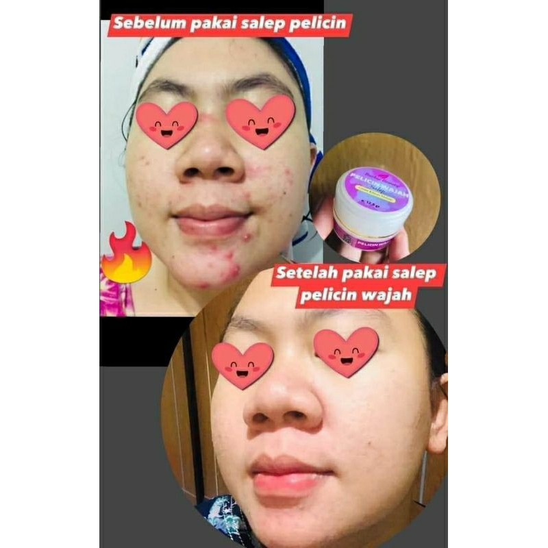 Paket usaha salep pelicin wajah by Barbie beuty produk ori 100%