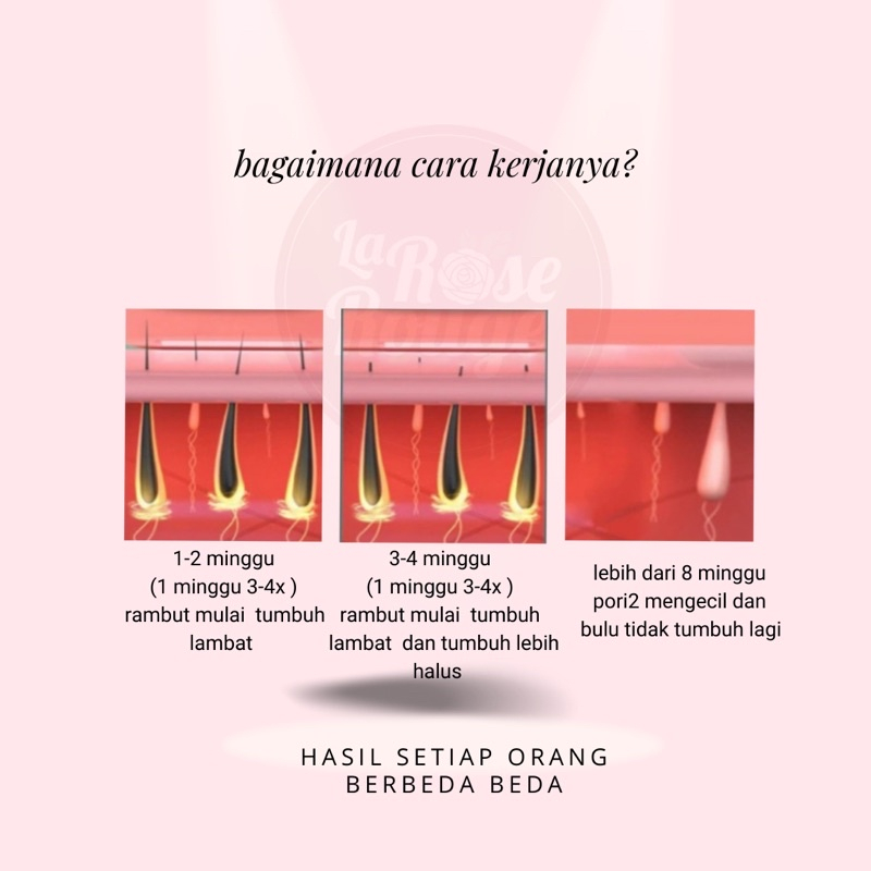 Jud Bear IPL Hair Removal Laser Portable (White)