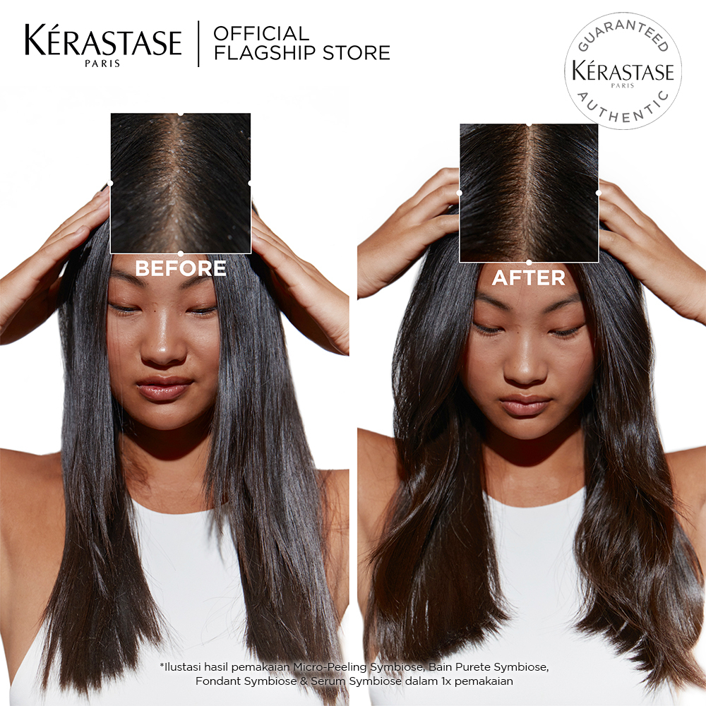 Kerastase Kondisioner Anti Ketombe - Fondant Symbiose 200ml Anti-Dandruff Conditioner