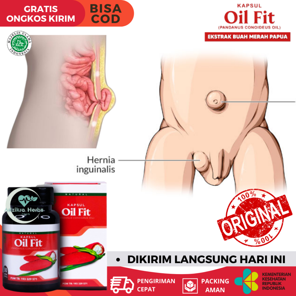 Obat Turun Berok Pria, Obat Testis Bengkak Sebelah, Obat Turun Berok, Obat Hernia Herbal, Obat Herni