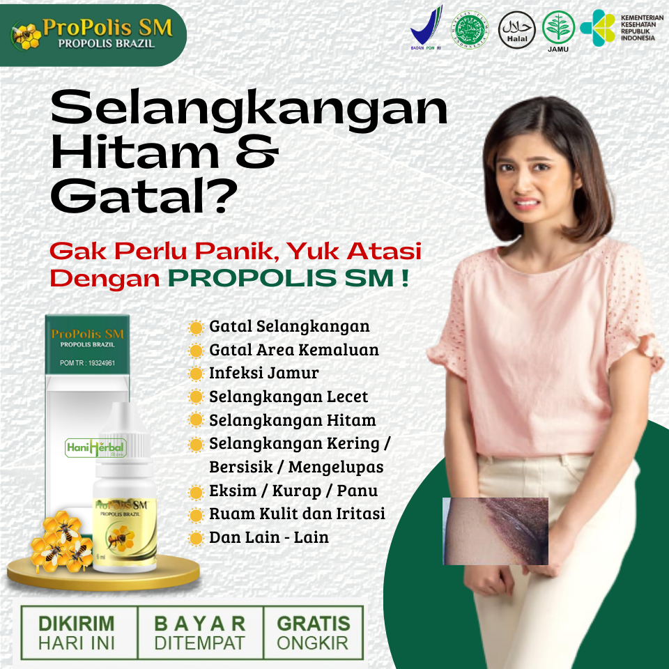 Obat Oles Pemutih Selangkangan Hitam, Obat Gatel Selangkangan, Berjamur, Lecet, Borok - Propolis SM