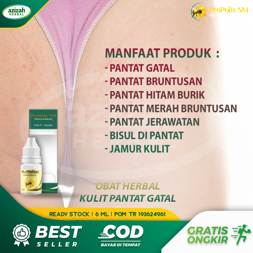 Obat Pantat Gatal Bentol Bruntusan Kulit Pantat Hitam Burik Penghilang Gatal Kulit Bokong Obat Oles 