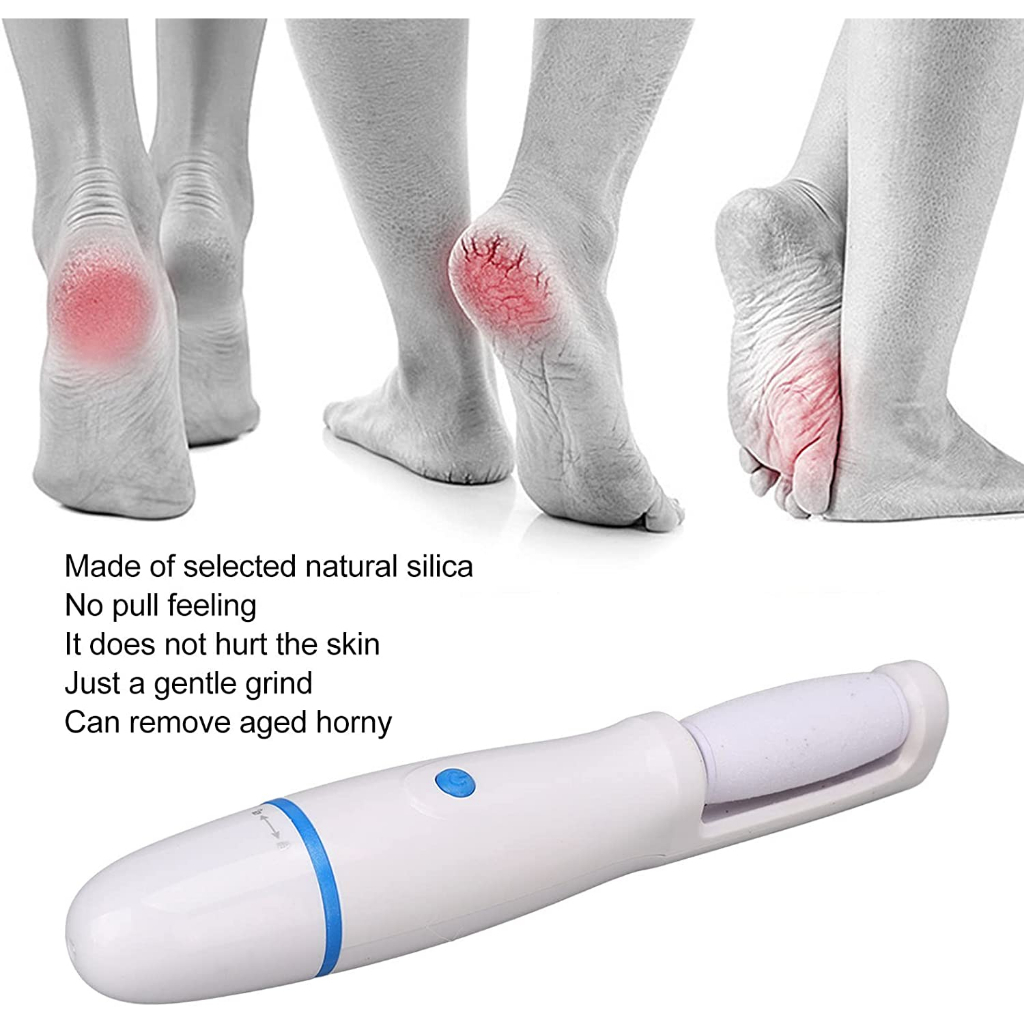 Callous Remover NEW Find Back Foot Pedicure Penghalus Kulit Kasar 0887