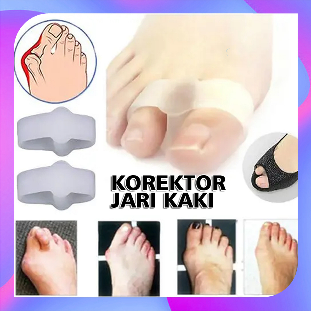 ALAT PELURUS JEMPOL JARI KAKI/ KOREKTOR BUNION ANTI NYERI