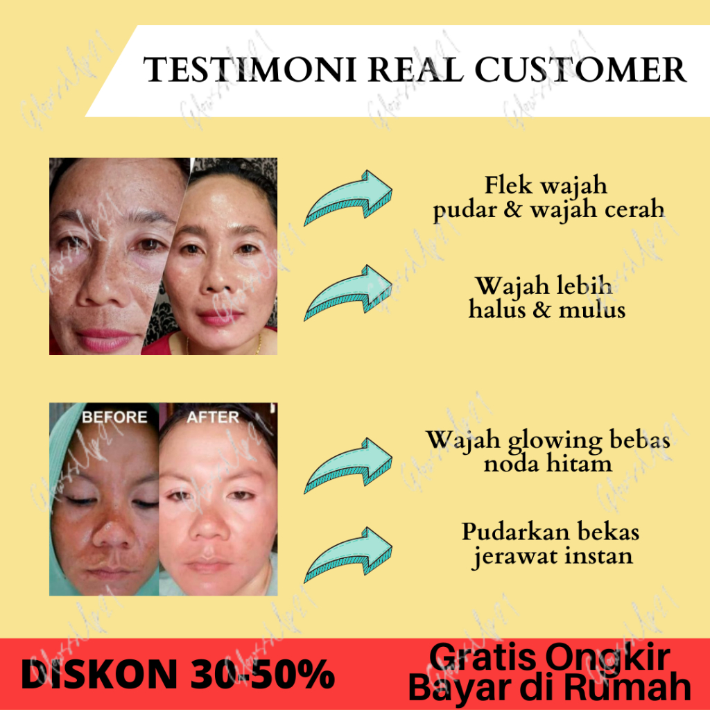 ERTOS ASTAXANTHINE WHITENING ESSENCE CREAM - CREAM PEMUTIH FLEK HITAM