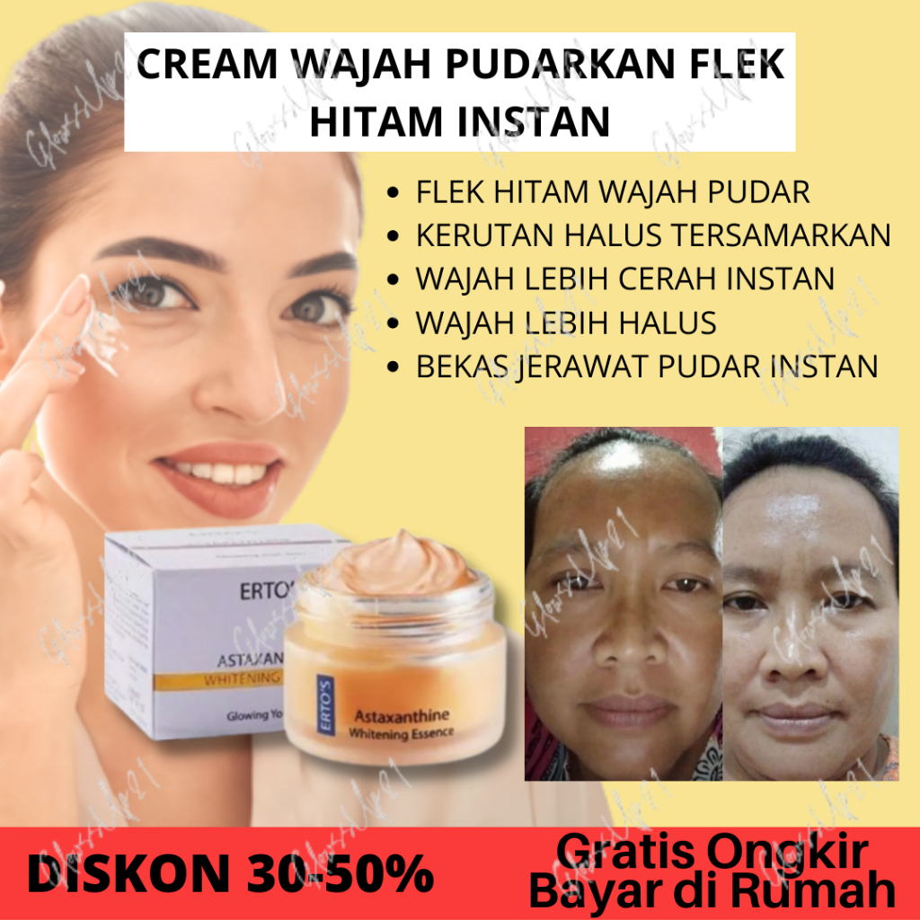 ERTOS ASTAXANTHINE WHITENING ESSENCE CREAM - CREAM PEMUTIH FLEK HITAM