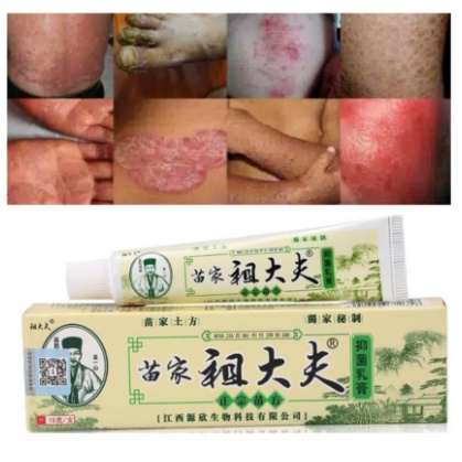 ZUDAIFU Salep Obat Untuk Alergi - Salep Penghilang Gatal Salep Kulit /Jerawat/Eksim/Psoarisis | Salep Gatal