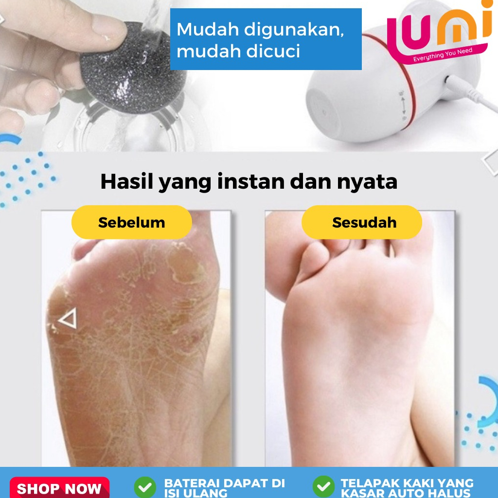 Alat Penghalus Tumit Kaki Perawatan Kulit Kapalan Foot Pedicure Elektrik Otomatis