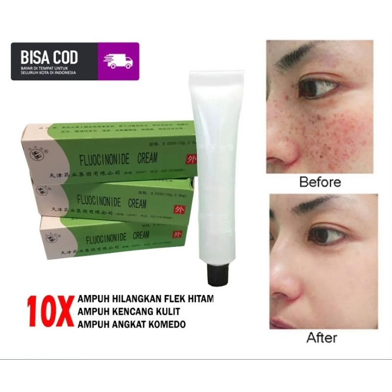 Salep walet penghilang flek hitam//Salep walet original//Per pcs