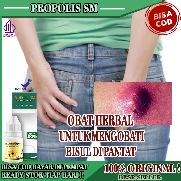 Obat Bisul Di Pantat,  Obat Herbal Bisulan Dengan Proskin, Obat Bisul Bernanah, Mengatasi Bisul di B