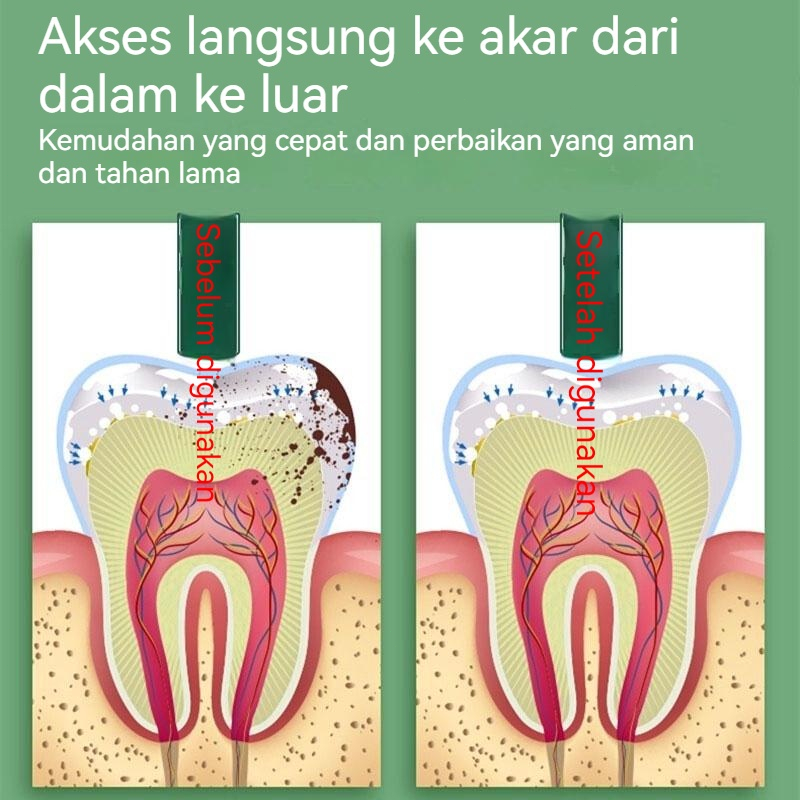 Obat sakit gigi spray Perawatan gigi Gusi bengkak semprot 20ML Herbal ampuh Mulut sariawan / Sakit gigi / Radang gusi / Berlubang / Bau mulut Antibakteri herbal perawatan mulut tersedia untuk dewasa dan anak-anak pereda nyeri cepat