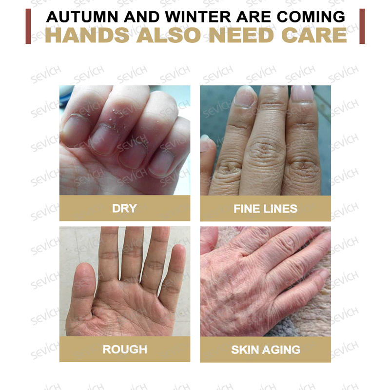 SISKALEY Niacinamide Whitening Hand Cream Moisturizing And Hydrating Repair Soothe Soften Improve Hand Skin 30g