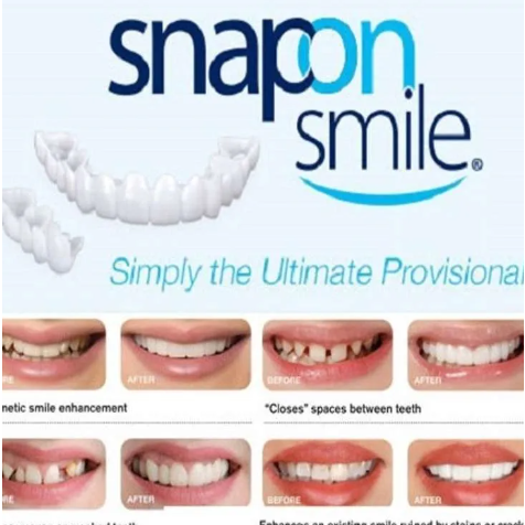 Original 100% Snap On Smile Sepasang Gigi Palsu Silicon 1 Set Atas Bawah - gigi bisa makan - tutupi gigi ompong - tambal gigi berlubang - gigi nap on smile - gigi penunjang penampilan - sepasang gigi atas bawah