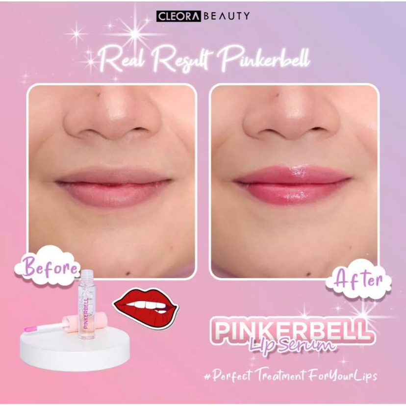 CLEORA Pinkerbell Lip Serum