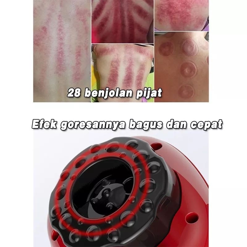 ALAT KERIK KEROKAN BEKAM ELEKTRIK MASSAGE SCRAPING ELEKTRIC FISIOTERAPI