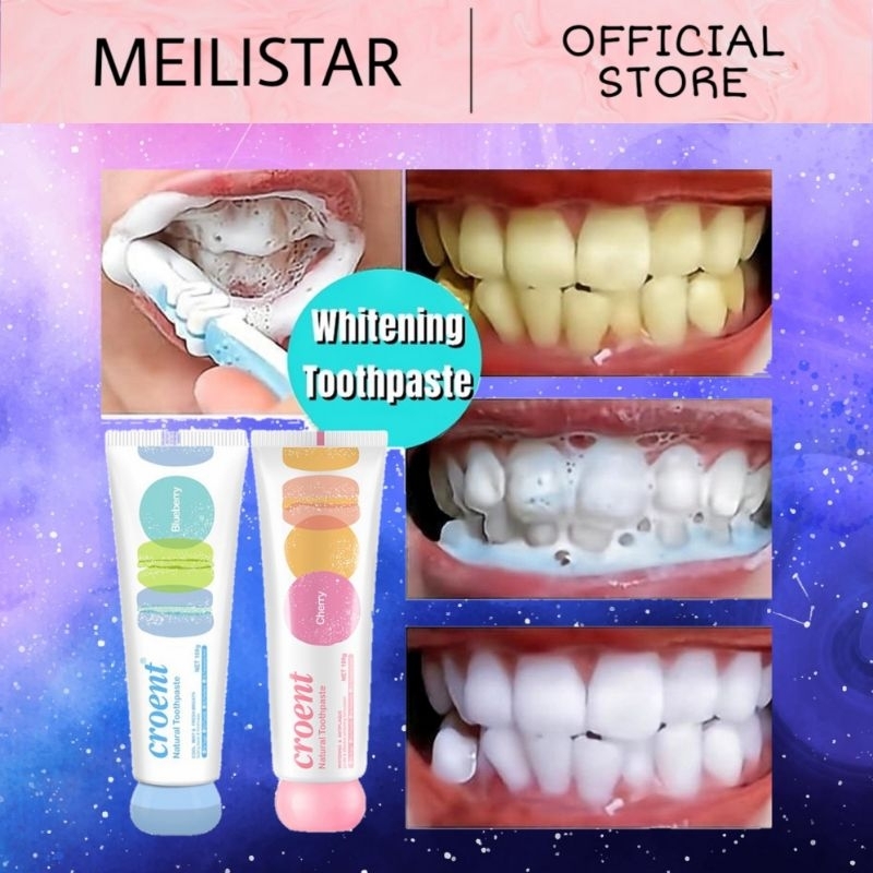 CROENT Pasta Gigi Korea Macaron / Whitening Toothpaste Cherry Blueberry Lemon Lime Peach