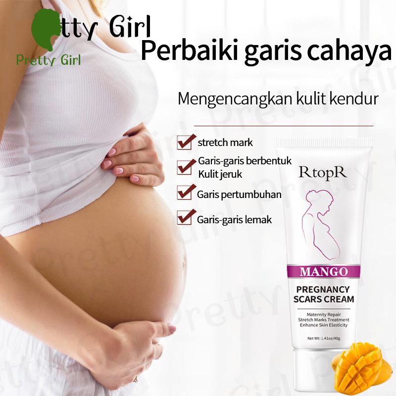 【asli】RtopR  Remove Pregnancy Scars Cream- Stretchmark Cream-Penghilang Strechmark-Perawatan Tubuh  Penghilang bekas luka ampuh