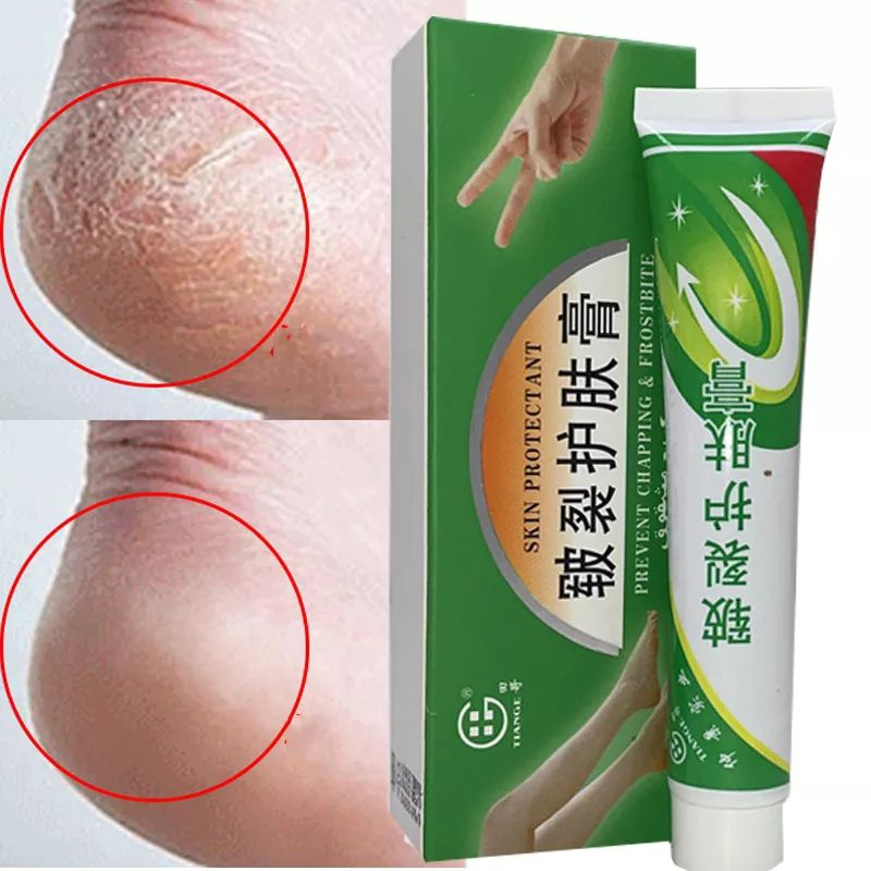 Salep Tumit Kaki Pecah dan Kering Original 25gr Protectant dan Peeling