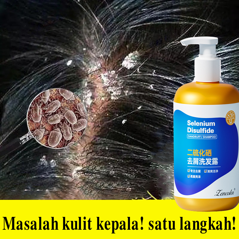 Obat ketombe Sampo ketombe Obat Ketombe Rambut Rontok Berkerak Sampo 300ML Efesiensi menghilangkan ketombe/Cepat anti gatal/Memuluskan rambut/Menjaga kulit kepala