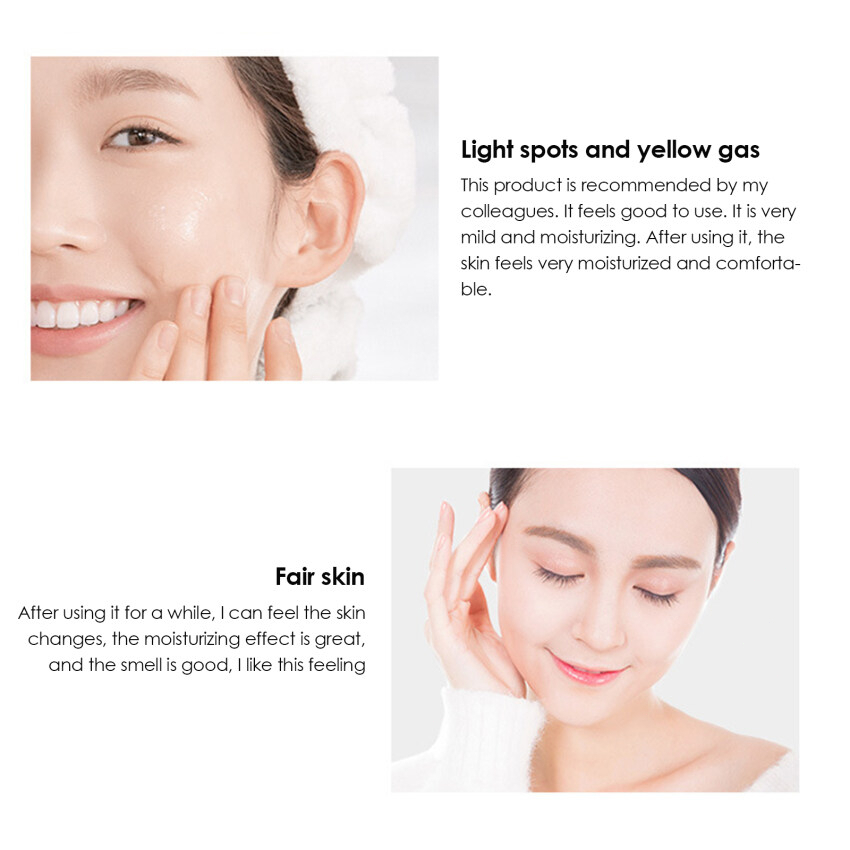 6-6 Youbuy Whitening Freckle Cream Remove Dark Spots Anti Freckle Cream Niacinamide Fade Pigmentation Melasma Brighten Creams