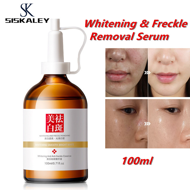 SISKALEY 100ml Nicotinamide Whitening Serum Freckles Remove Dark Spots Melasma Brighten Lighten Melanin Improve Dull Anti-Aging