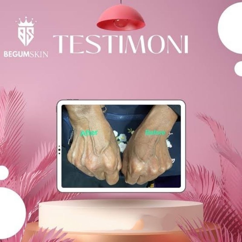 Begumskin Skincare Hand Body Lotion | Begum Skin Whitening BPOM Resmi 250ml