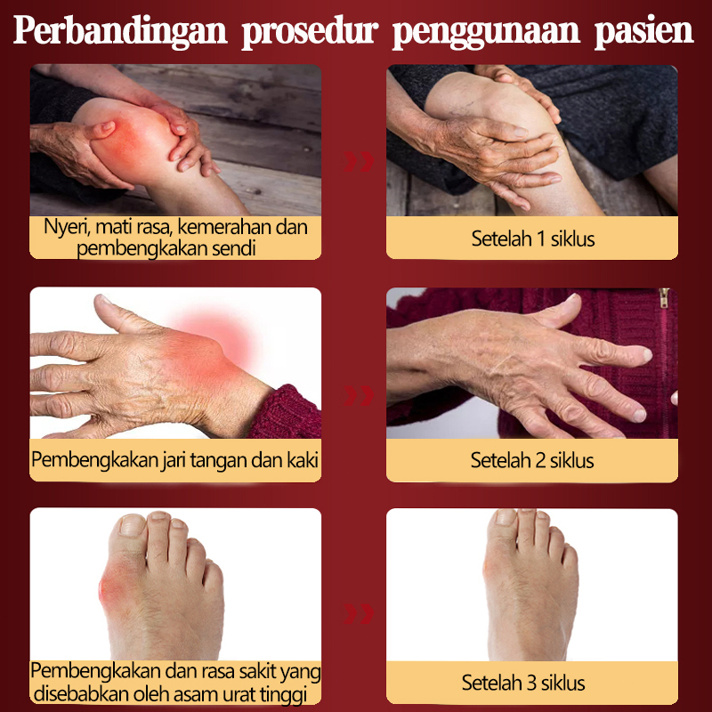 Obat Asam urat Rematik Radang Sendi Herbal 30ml Semprotan Rematik Pereda Nyeri Pada Sendi Pereda Nyeri Bunion Pengobatan Yang Efektif REMATIK ASAM URAT NYERI OTOT