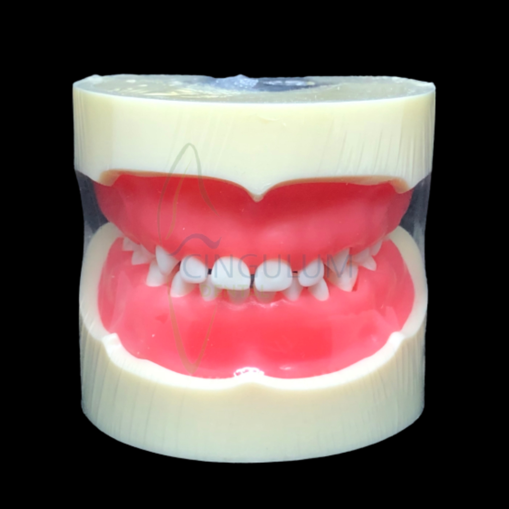 Dental model study gigi peraga lepas pasang obeng baut / Model Gigi Typodont Anak Gingiva Elastis Pa