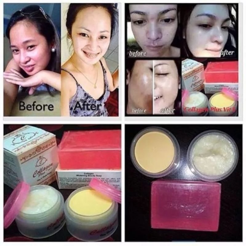 COLLAGEN CREAM SIANG DAN MALAM