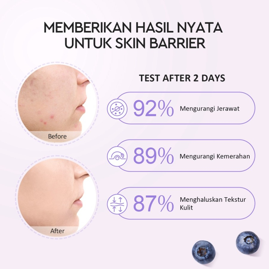 Glad2Glow 5% Blueberry Moisturizer Cream 5x Ceramide Skin Barrier Repair 25g | Pelembab Wajah Pemutih Wajah Facial Moisturizer