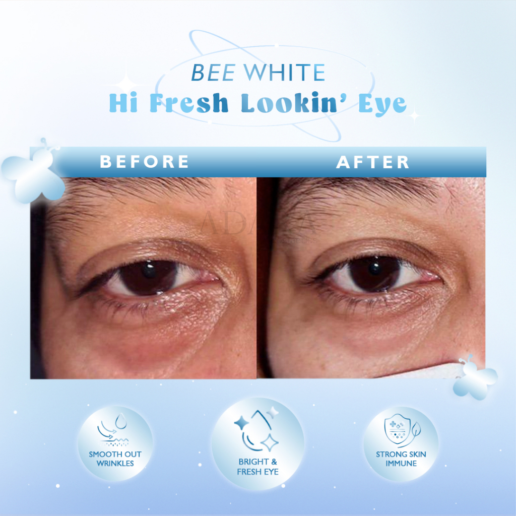 ADARA - BEE WHITE EYE DO CARE
