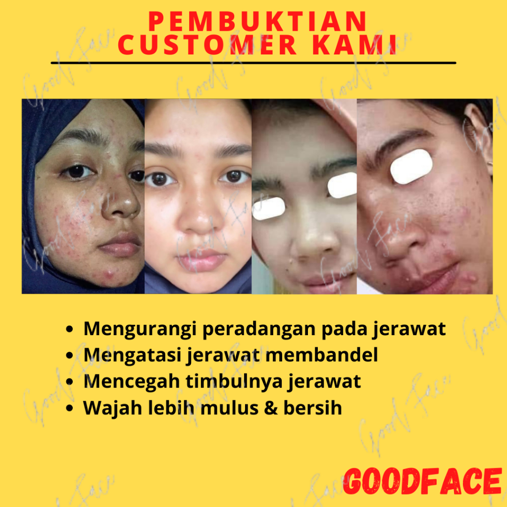 PEMBERSIH JERAWAT BREYLEE TEA TREE ACNE TREATMENT PEN