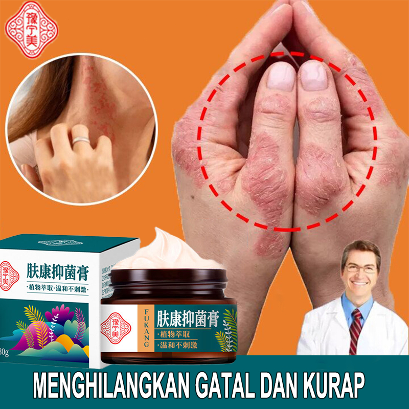 salep gatal gatal obat gatal gatal psoriasis 30g Salep Dermatologis Antijamur yang Menenangkan Dermatitis Psoriasis Eksim Krim Pereda Gatal