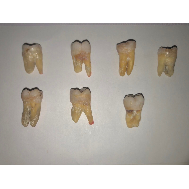 Gigi Molar asli untuk praktikum dokter gigi (FKG)