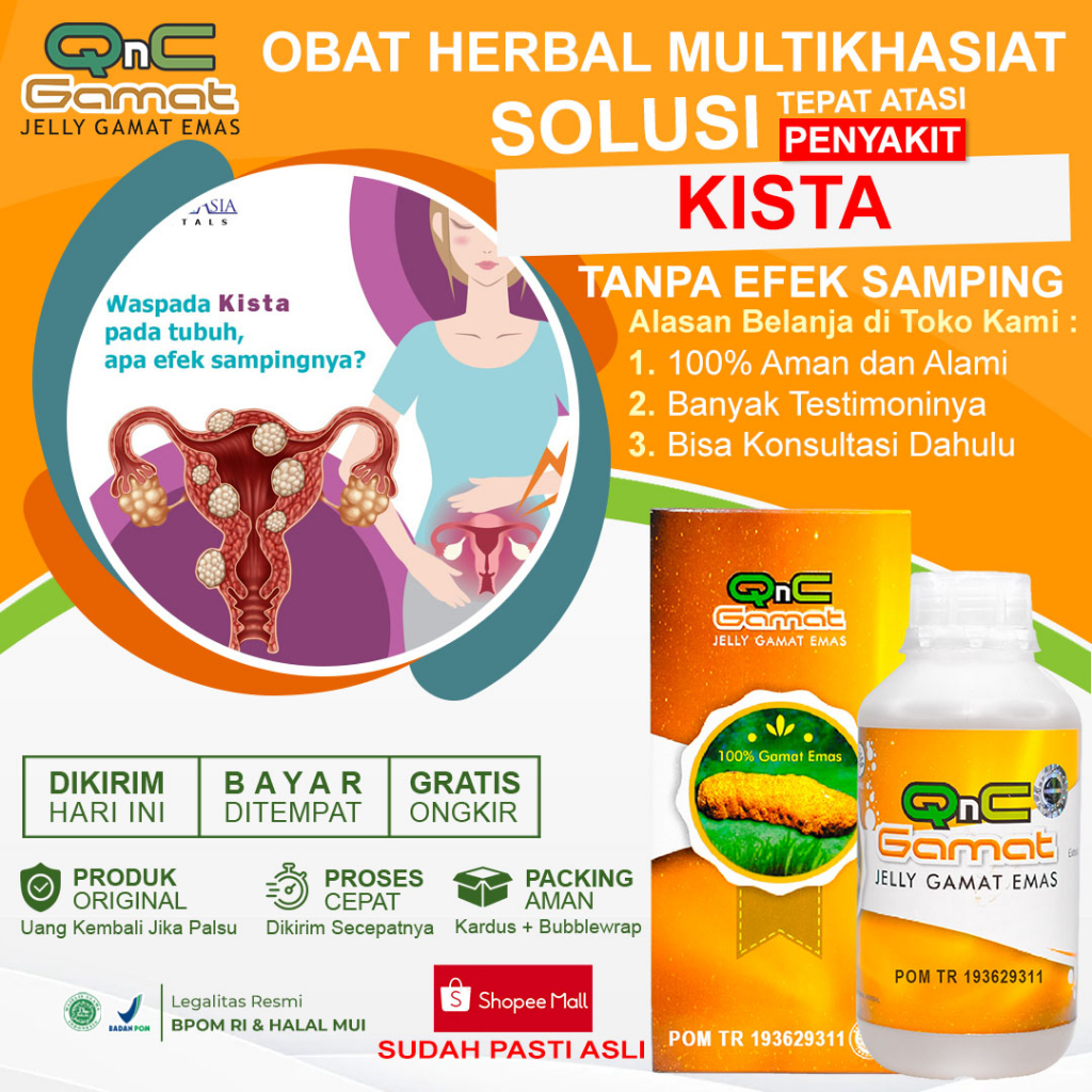 Obat Kista Kista Obat Miom Kista Bartholin Kista Ovarium Kista Epidermoid Kista Payudara Kista Gangl