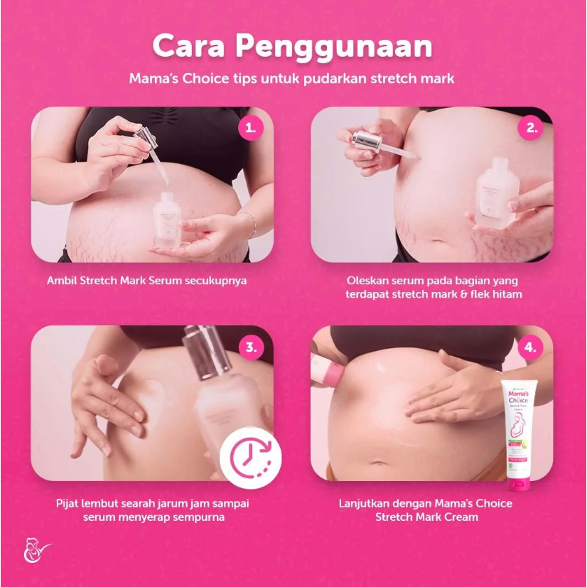 *FRAULEINCO* Mama's Choice Stretch Mark Cream 100GR / SERUM Stretch Mark