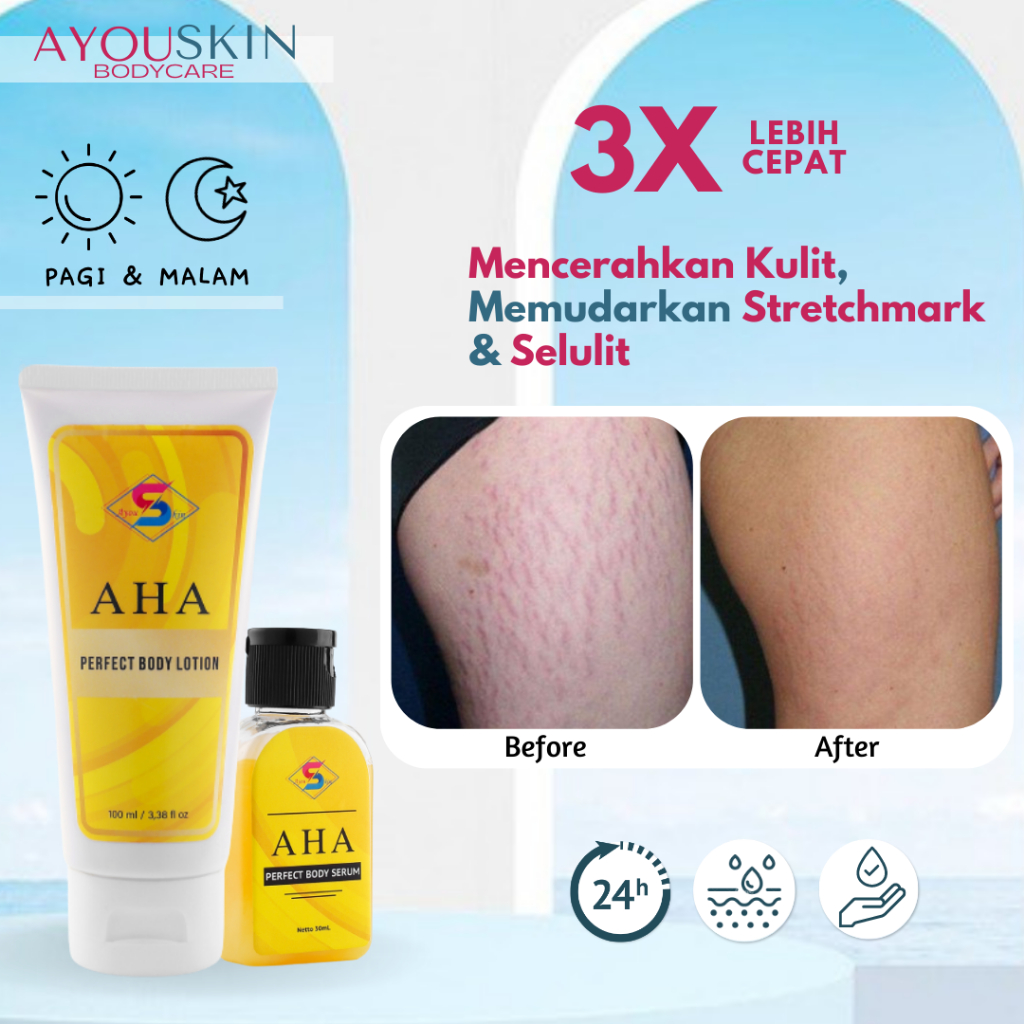 Krim Stretch Mark, Stretch mark kehamilan, Stretchmark Cream Krim Stretch mark Body Lotion Menghilan