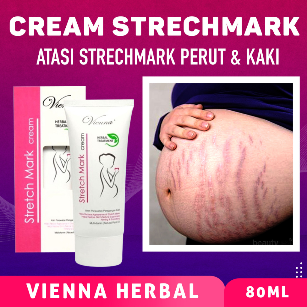 Vienna Stretch Mark Cream 80ml Tube Ori BPOM Penghilang Stretch Mark Cream Penghilang Bekas Luka